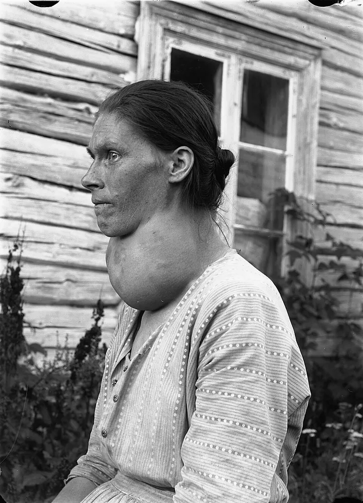 Kone_med_stor_struma.webp